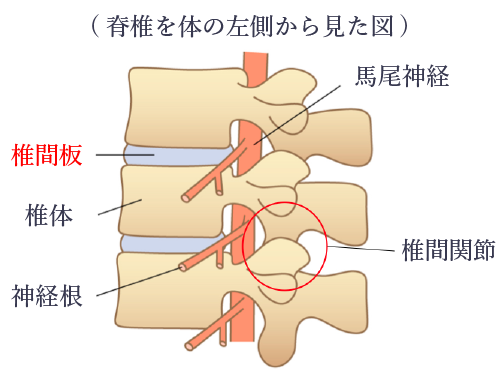 腰椎変性疾患